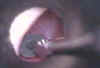 EarTubeVideo41.jpg (4955 bytes)